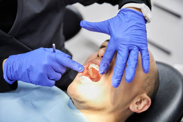 Best Emergency Dental Care for Broken or Chipped Teeth in Cascade Chipita Park, CO